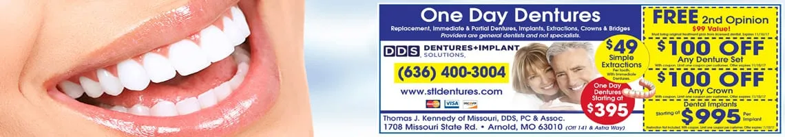 dentures Cahokia Heights il dental implants